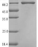 Pseudomonas sp. Carboxypeptidase G2 (cpg2) Recombinant Protein - BioCrest Sci