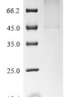 Orthohantavirus hantanense Envelopment polyprotein, partial Recombinant Protein - BioCrest Sci