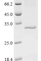 Human Serine/threonine-protein phosphatase PGAM5, mitochondrial (PGAM5), partial Recombinant Protein, C-His, aa 30–289, Baculovirus - BioCrest Sci