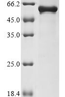 Human Calcium-binding and coiled-coil domain-containing protein 2 (CALCOCO2) Recombinant Protein, N-10His - BioCrest Sci
