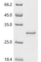 Escherichia coli O157:H7 Uncharacterized protein yqgB (yqgB) Recombinant Protein, N-GST - BioCrest Sci