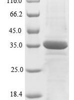 Human X-ray repair cross-complementing protein 5 (XRCC5), partial Recombinant Protein, N-10His/C-Myc - BioCrest Sci