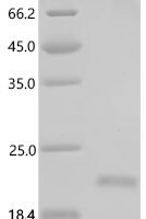 Human Lymphocyte antigen 6D (LY6D) Recombinant Protein, C-His - BioCrest Sci