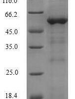 Arabidopsis thaliana Alcohol dehydrogenase class-3 (ADH2) Recombinant Protein - BioCrest Sci