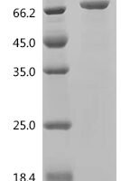 Human Kelch-like protein 32 (KLHL32) Recombinant Protein - BioCrest Sci
