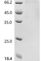 Human Angiopoietin-1 receptor (TEK), partial Recombinant Protein - BioCrest Sci