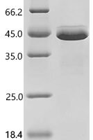Pig Pepsin A(PGA) Recombinant Protein - BioCrest Sci