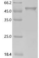 Human Alpha-1-antichymotrypsin (SERPINA3) Recombinant Protein, N-His - BioCrest Sci