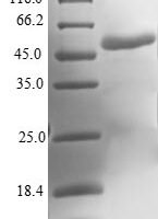 Human Molybdopterin synthase catalytic subunit (MOCS2) Recombinant Protein - BioCrest Sci
