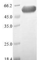 Human Cytosolic endo-beta-N-acetylglucosaminidase (ENGASE) Recombinant Protein - BioCrest Sci