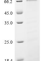 Corynephage beta DT3C protein, partial Recombinant Protein - BioCrest Sci