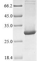 Human Toll-like receptor 7 (TLR7), partial Recombinant Protein - BioCrest Sci