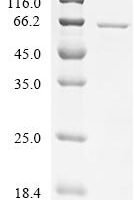 Yarrowia lipolytica ATP citrate synthase Recombinant Protein, C-His, aa 1–497 - BioCrest Sci