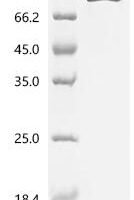 Mouse Complement factor B (Cfb) Recombinant Protein, C-10His - BioCrest Sci