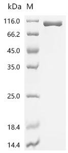 Mouse Complement factor B (Cfb) Recombinant Protein, C-10His, Mus musculus (Mouse), Mammalian cell, C-terminal 10xHis-tagged, 85.6 kDa, purity >≥ 95% as determined by SDS-PAGE.