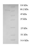Saccharomyces cerevisiae Cystathionine beta-lyase (STR3) Recombinant Protein, Saccharomyces cerevisiae (strain ATCC 204508 / S288c) (Baker's yeast), E.coli, N-terminal 6xHis-SUMO-tagged, 67.8 kDa, purity >≥ 90% as determined by SDS-PAGE.