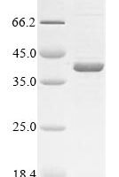 Neisseria meningitidis serogroup B Major outer membrane protein P.IB (porB) Recombinant Protein, N-His, aa 20–331, UniProt P30688 - BioCrest Sci