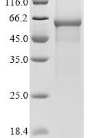Citrus unshiu Limonoid UDP-glucosyltransferase Recombinant Protein - BioCrest Sci
