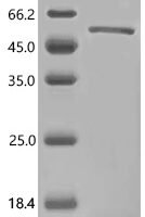Human RecQ-like DNA helicase BLM (BLM) (K24A), partial Recombinant Protein, C-His - BioCrest Sci