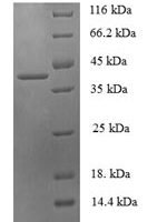 Human 14 kDa phosphohistidine phosphatase (PHPT1) Recombinant Protein - BioCrest Sci