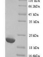 Human Immunoglobulin lambda-like polypeptide 5 (IGLL5) Recombinant Protein, N-His, aa 36–214, Yeast - BioCrest Sci