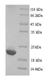 Human Immunoglobulin lambda-like polypeptide 5 (IGLL5) Recombinant Protein, N-His, aa 36–214, Yeast, Homo sapiens (Human), Yeast, N-terminal 6xHis-tagged, 21.3 kDa, purity >≥ 90% as determined by SDS-PAGE.