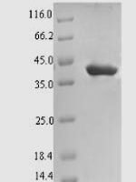 Ipomoea batatas Sporamin A Recombinant Protein - BioCrest Sci