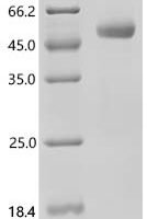 Macaca mulatta Interleukin-2 (IL2) Recombinant Protein, C-hFc1 - BioCrest Sci