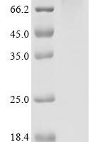 Human Epidermal growth factor receptor (EGFR), partial Recombinant Protein, C-His-G4S-SpyTag003 - BioCrest Sci