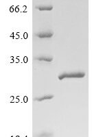 Mouse Glutathione S-transferase Mu 1 (Gstm1), partial Recombinant Protein, N-His - BioCrest Sci