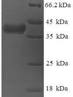 Human DnaJ homolog subfamily B member 8 (DNAJB8) Recombinant Protein - BioCrest Sci