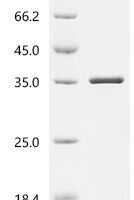 Escherichia coli N-acetylmuramoyl-L-alanine amidase AmiD (amiD) Recombinant Protein, N-10His/C-Myc - BioCrest Sci