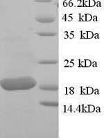 Sheep Tumor necrosis factor (TNF), partial Recombinant Protein, N-His - BioCrest Sci