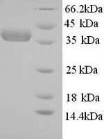 Human Nicotinate phosphoribosyltransferase (NAPRT), partial Recombinant Protein, N-His - BioCrest Sci