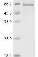 Human SPARC-related modular calcium-binding protein 2 (SMOC2) Recombinant Protein - BioCrest Sci