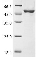 Salmonella typhi DNA gyrase subunit B (gyrB), partial Recombinant Protein - BioCrest Sci