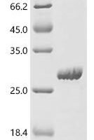 Human Endogenous retrovirus group K member 113 Pro protein (HERVK_113) Recombinant Protein - BioCrest Sci