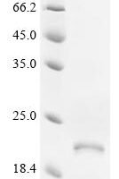 Human G-protein coupled receptor family C group 5 member B (GPRC5B), partial Recombinant Protein - BioCrest Sci