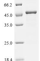 Human Guanine nucleotide-binding protein G (i) subunit alpha-3 (GNAI3) Recombinant Protein, C-His - BioCrest Sci