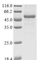 Human Atrial natriuretic peptide receptor 2 (NPR2), partial Recombinant Protein, N-10His/C-Myc - BioCrest Sci