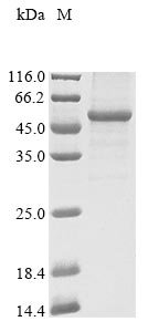 Human Atrial natriuretic peptide receptor 2 (NPR2), partial Recombinant Protein, N-10His/C-Myc, Homo sapiens (Human), Baculovirus, N-terminal 10xHis-tagged and C-terminal Myc-tagged, 52.4 kDa, purity >≥ 85% as determined by SDS-PAGE.