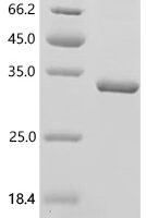 Human Bile salt export pump (ABCB11), partial Recombinant Protein, C-His, aa 1036–1256 - BioCrest Sci