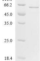 Human Elongation factor 1-alpha 1 (EEF1A1)(K313R) Recombinant Protein - BioCrest Sci