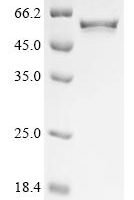 Epstein-Barr virus Protein LF2 (LF2) Recombinant Protein - BioCrest Sci