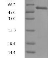 Human Cyclin-A1 Isoform 2 (CCNA1), partial Recombinant Protein - BioCrest Sci