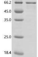Chicken Vitamin D3 receptor (VDR) Recombinant Protein - BioCrest Sci