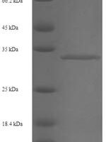 Human Putative RNA-binding protein 3 (RBM3) Recombinant Protein, N-His-SUMO - BioCrest Sci