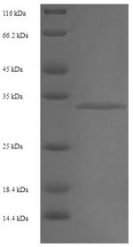 Human Putative RNA-binding protein 3 (RBM3) Recombinant Protein, N-His-SUMO, Homo sapiens (Human), E.coli, N-terminal 6xHis-SUMO-tagged, 33.2 kDa, purity >≥ 90% as determined by SDS-PAGE.
