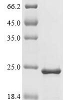 Human Tubulin-specific chaperone A (TBCA) Recombinant Protein - BioCrest Sci
