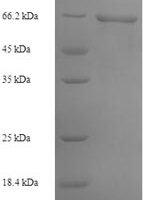 Bacteroides vulgatus Alpha-1,3-galactosidase B (glaB1) Recombinant Protein - BioCrest Sci